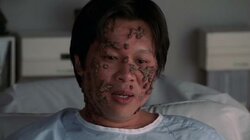 Nip/Tuck 5.20